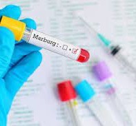 ماذا نعرف عن فيروس ماربورغ؟